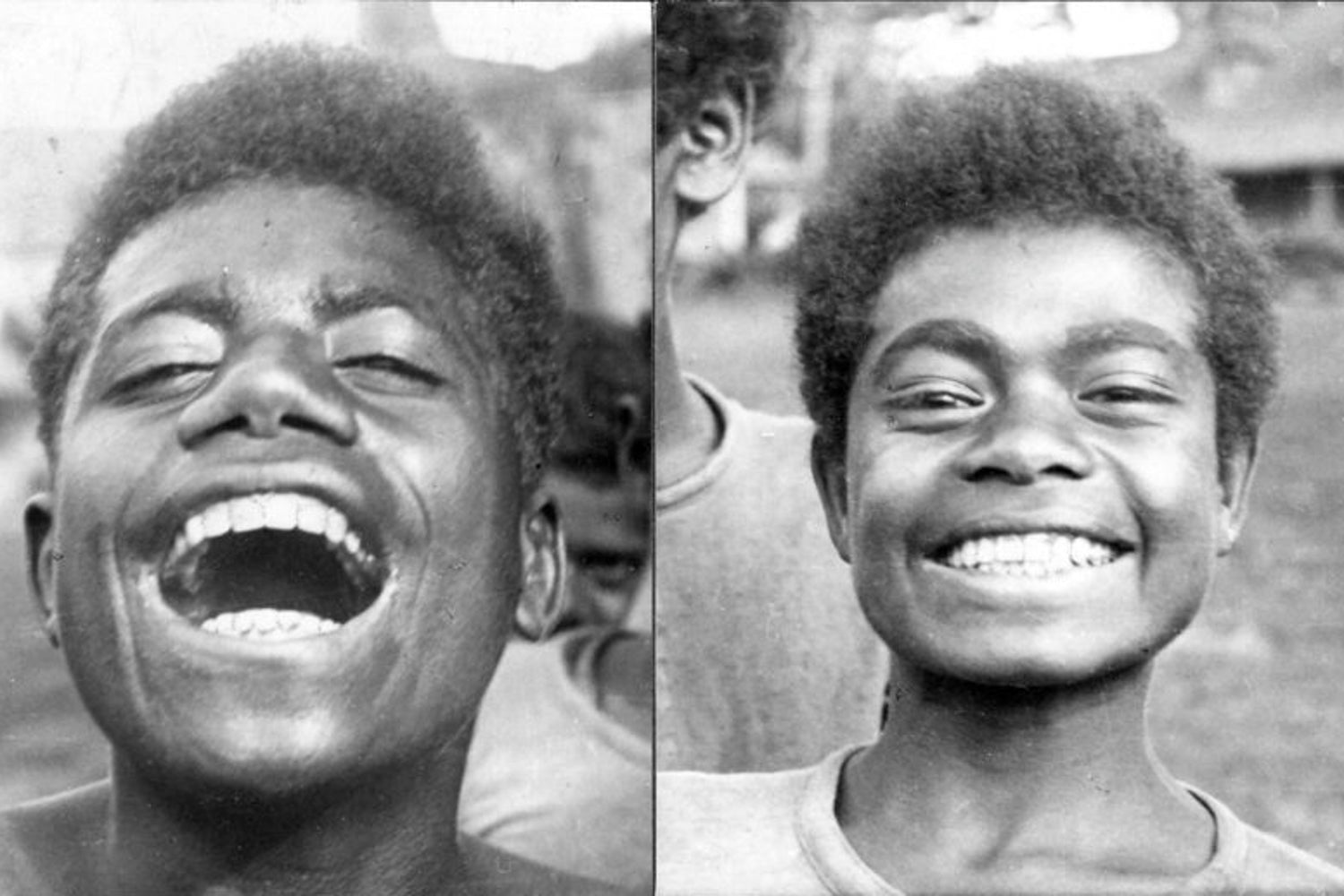 Discovering Weston A. Price: The Dentist Who Saw Beyond Teeth